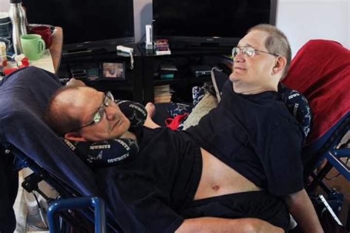 Conjoined Twins in Dayton Ohio: A Story of Resilience and Community Support