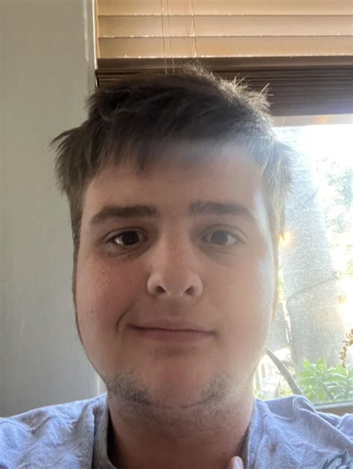 Exploring the Allure of Stackswopo Face