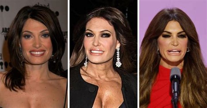 Kim Guilfoyle Without Makeup: Embracing Natural Beauty