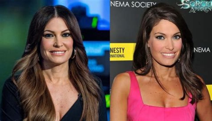 Kimberly Guilfoyle's Journey Before Surgery: A Comprehensive Exploration
