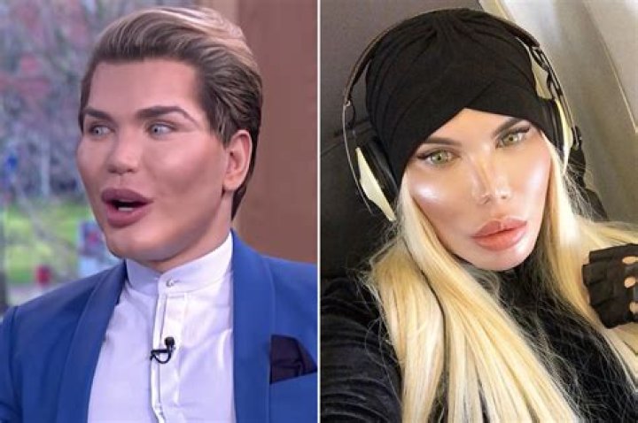 Transforming Identity: The Fascinating Journey of Ken Plastic Surgery Man