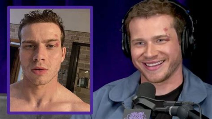 Unveiling the Truth About Oliver Stark's Birthmark